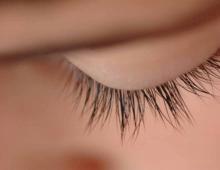 Eyelash loss in women and children: causes and treatment